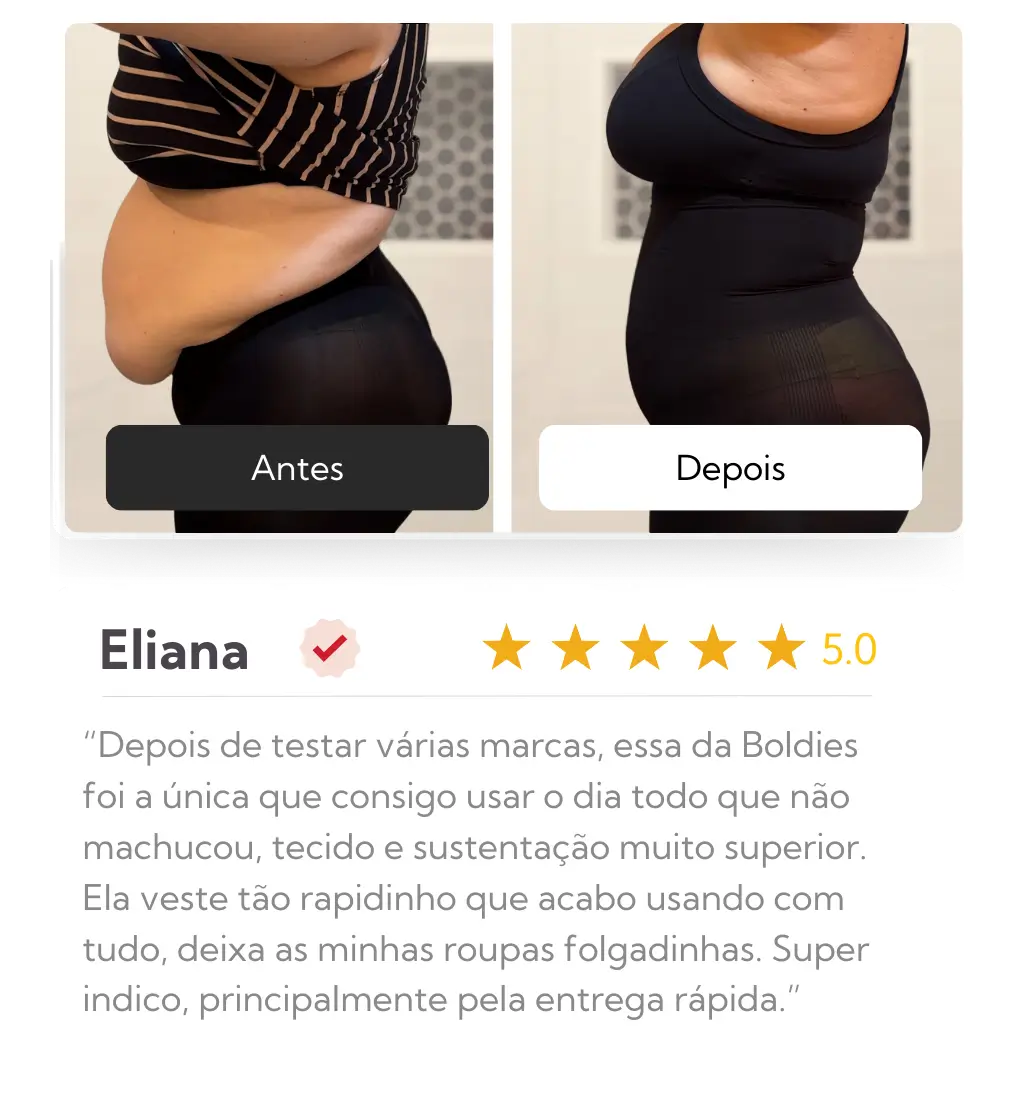 Eliana — antes e depois com Ultra Shaper