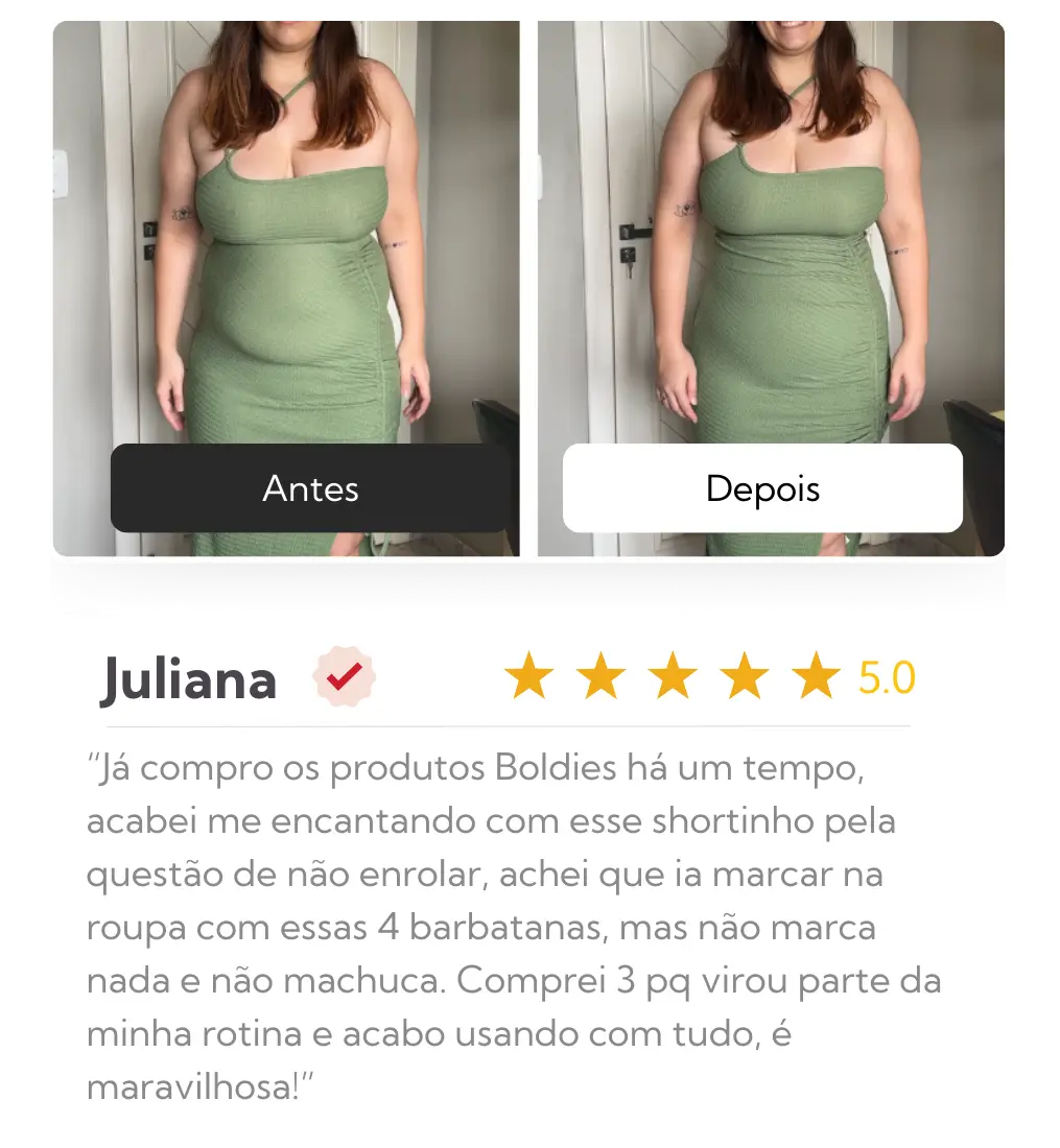 Juliana — antes e depois com Ultra Shaper